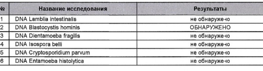 Простейшие обнаружены