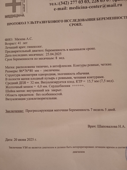 Узи