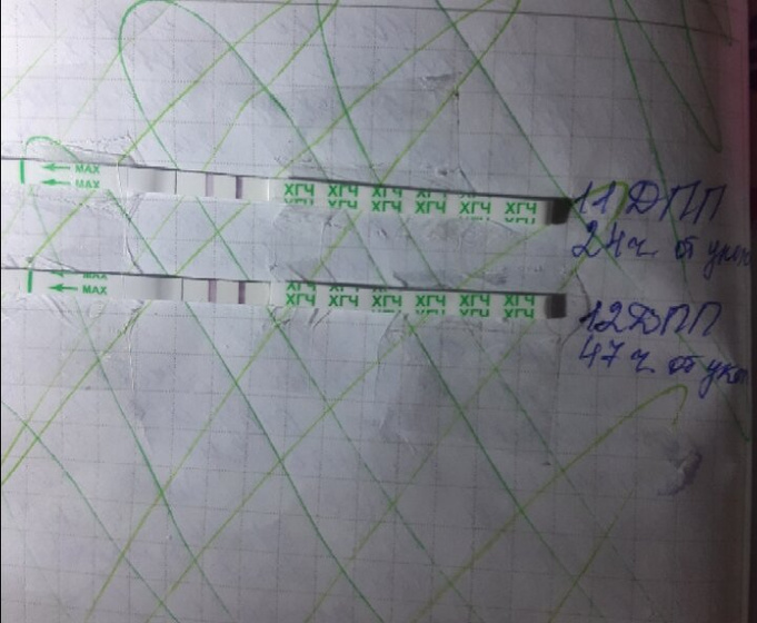 12 дпп