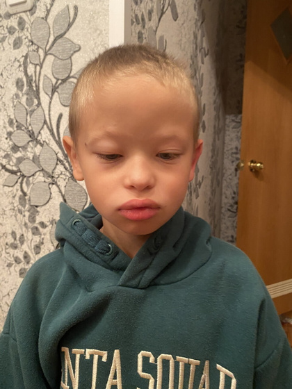 Энтеровирус