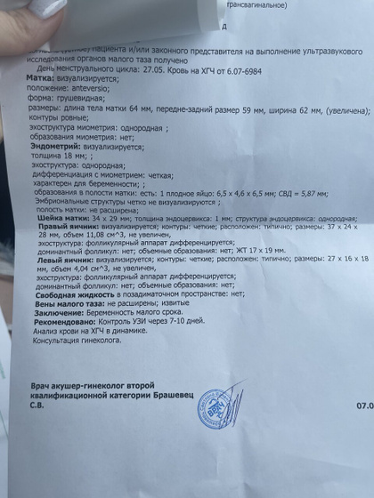 Ну вот прям я