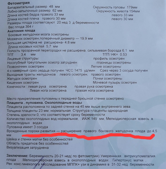 Не все хорошо складывается...