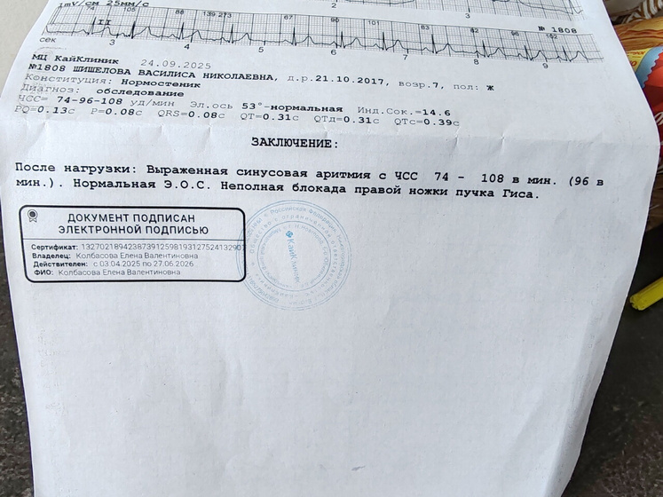 Экг результат