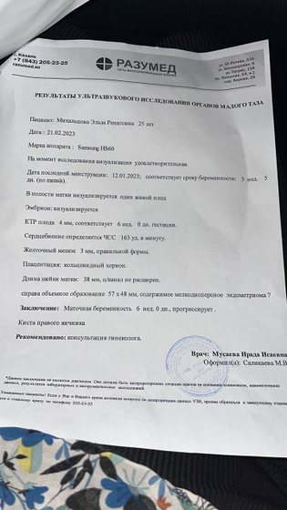Узи