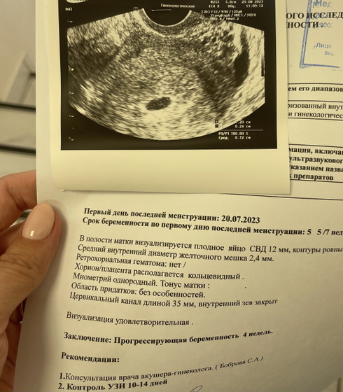 Первое узи. 5,7 акушерских.