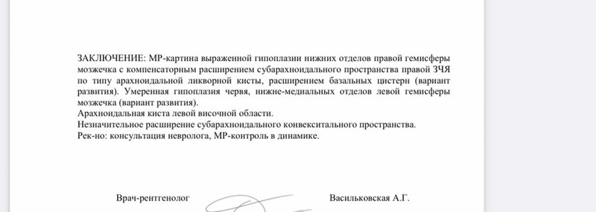 Как можно уснуть в аппарате мрт?! ?