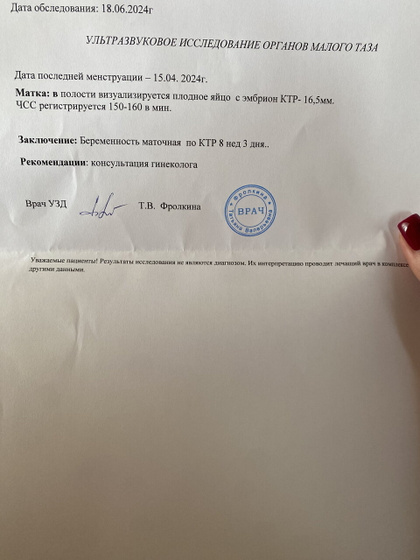 Узи в 10 недель