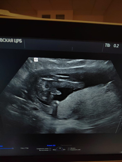 Наши счастливые 18 неделек ❤️