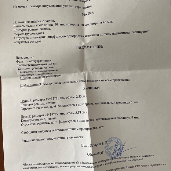 Узи перед Эко