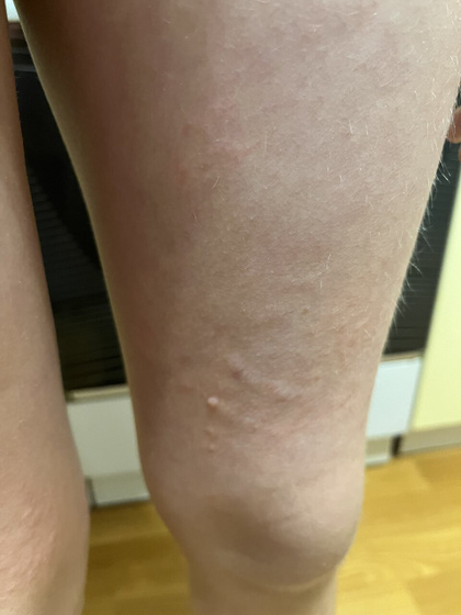 SOS?