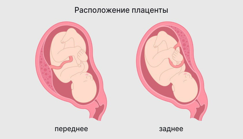 Здравствуйте, на каком сроке