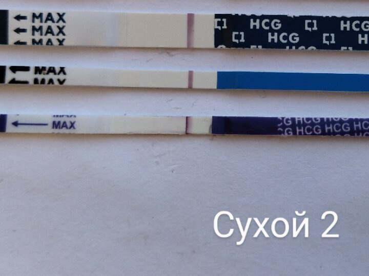 10 дпо. Хоть бы мои ?
