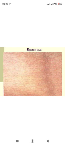 Краснота на теле. Аллергия?