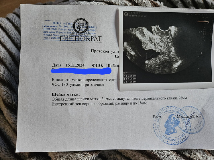 Цервикаметрия