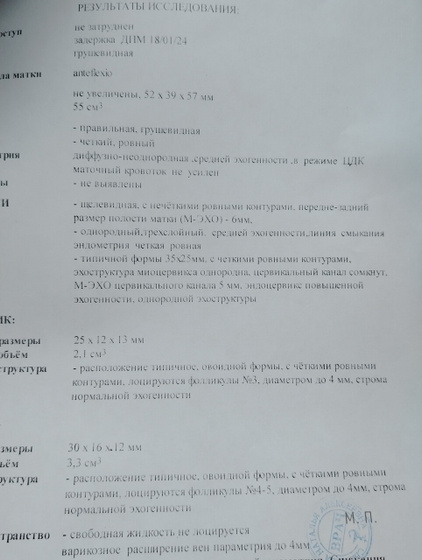 Узи после Б*Б.