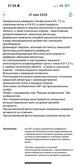 Делали ЭЭГ сегодня.