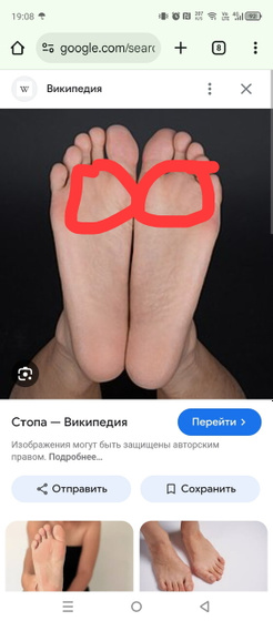Болят стопы