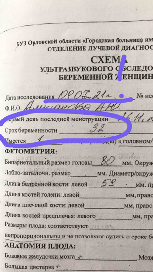 Срок по месячным 34