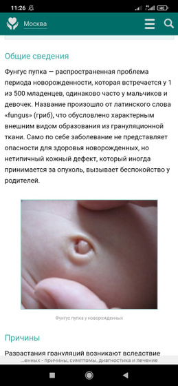 Фунгус пупка, Кто нибудь