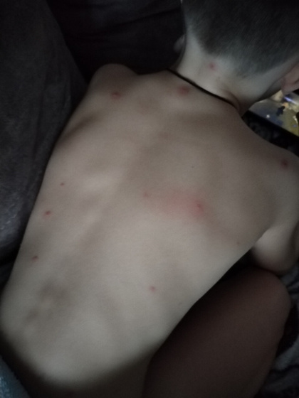 Девушки что это может быть? Хочу попасть к врачу конечно же