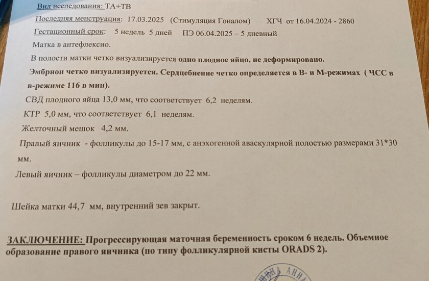 5 недель и 5 дней, первое УЗИ