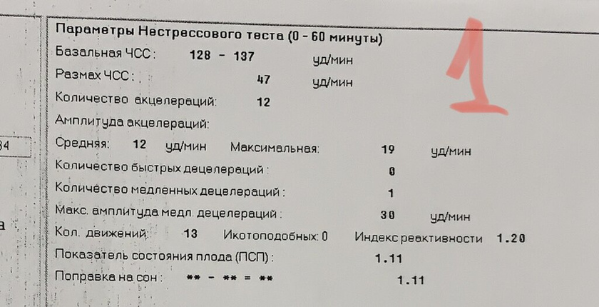 34 недели 2 дня. КТГ, допплер