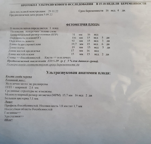 Ходила на узи,чтобы посмотреть пол. Срок 16+4