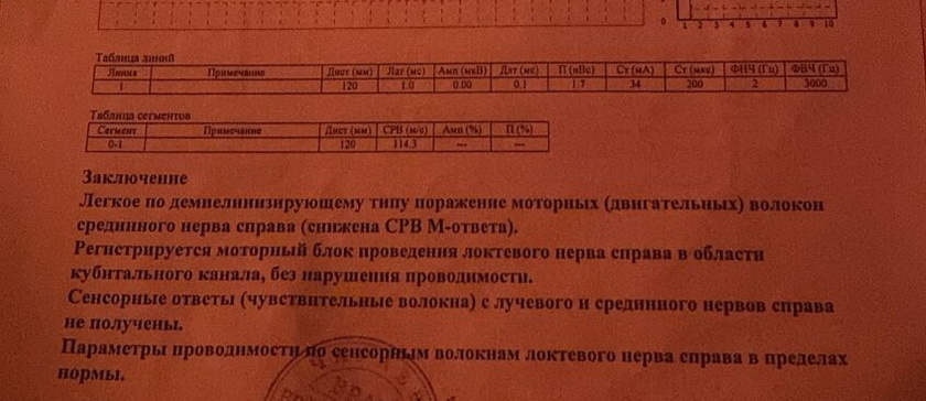 Результаты энмг