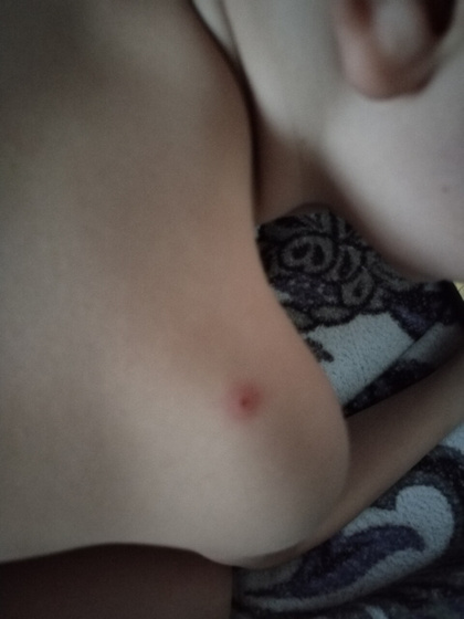 Девушки что это может быть? Хочу попасть к врачу конечно же