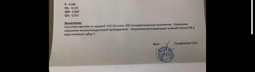 Кто понимает в экг?