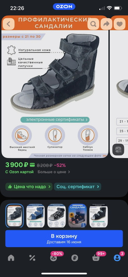 У сына 5лет вальгусная