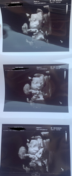 4D🥰😍