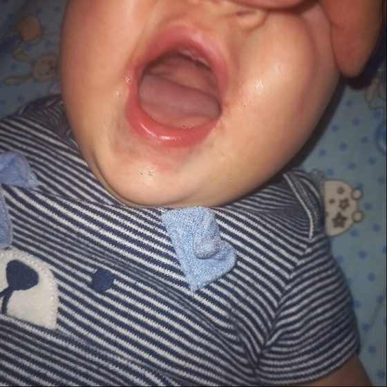 Девочки у ребенка ,на