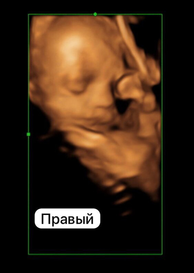 3Д узи это вещь 😍😍😍