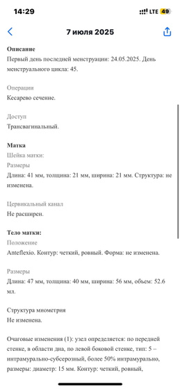 Удивительная беременность