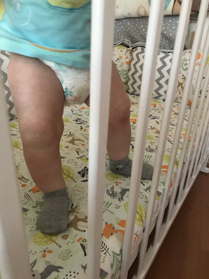 Сын встаёт у опоры с вывороченными наружу стопами