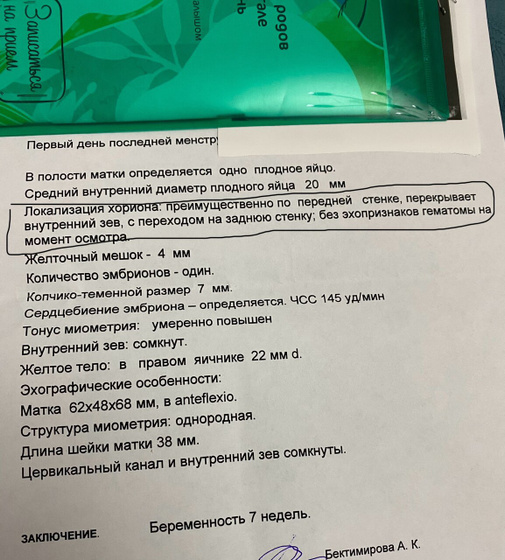 Узи