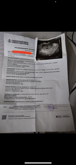 Анэмбриония?