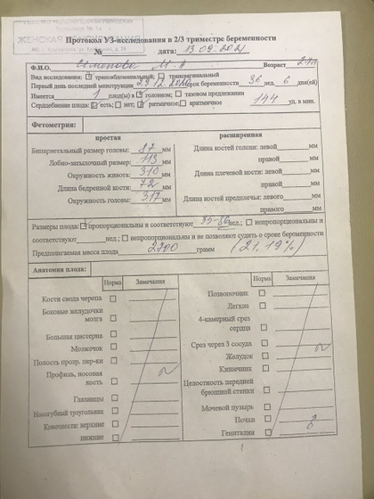 Узи+ доппоер 36 неделя?