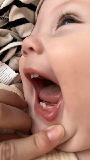7 зубик☺️🦷