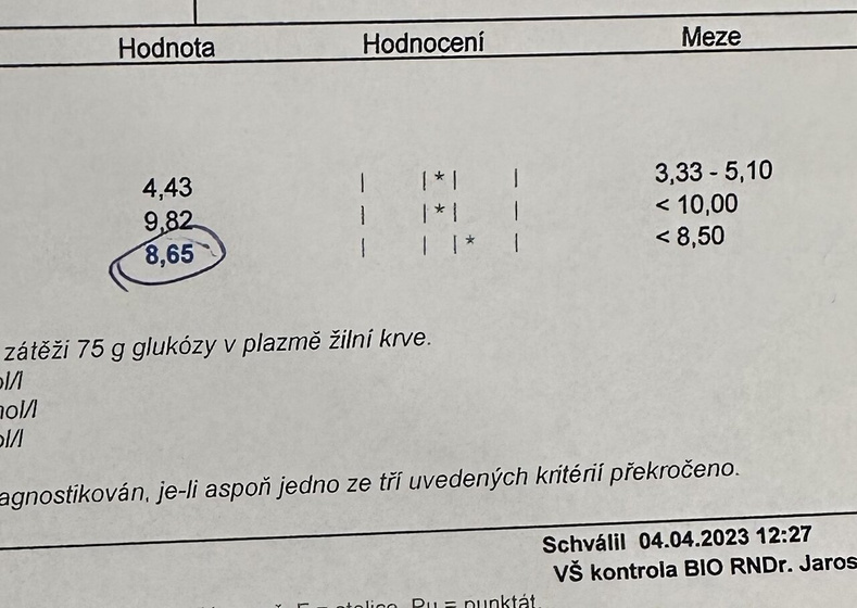 Гсд