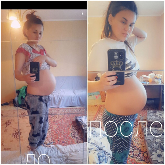 Живот опустился ?