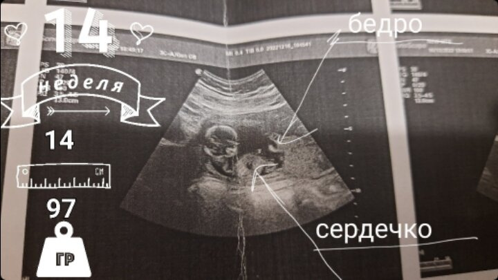Пост на память 💕