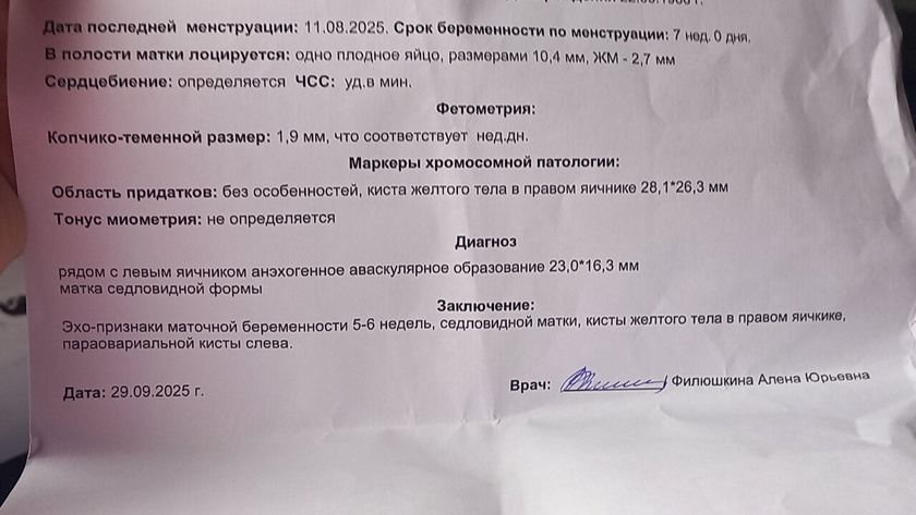 Сходила сегодня на первое узи😍