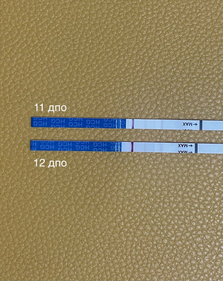 Хгч 12 дпо=13.3 (кдл)