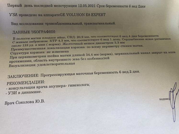 25 дпп