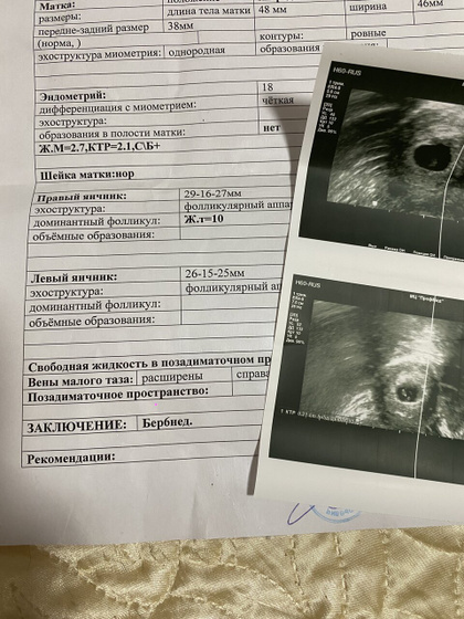 Узи на раннем сроке