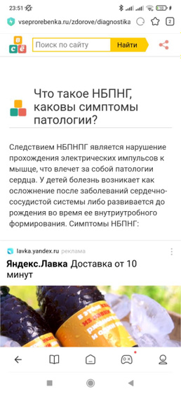 Неполная блокада правой ножки