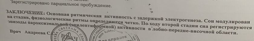 Дневное ээг во время сна