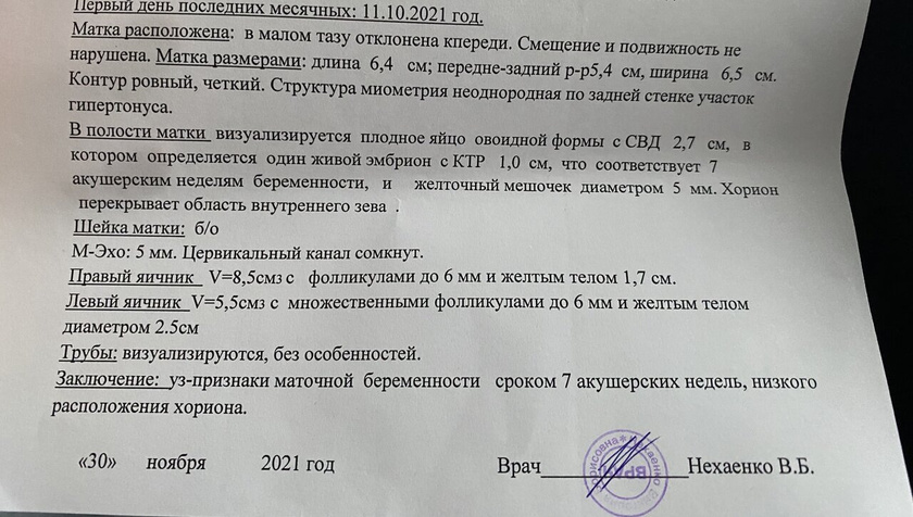 Узи